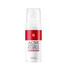 Tosowoong Acne Centella Bubble Cleansing Foam