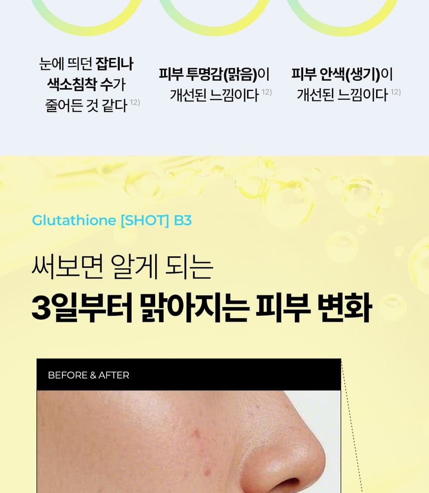 it's skin glutathione shot b3 Frontrow Luxxe White Enhanced Glutathione Reviews  Page 101