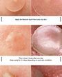 Witch Piggy Hell Pore Blemish Spot Patch