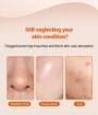 Blackhead Scraper Remover