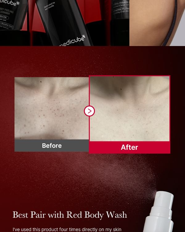 Red Acne Body Peeling Shot 