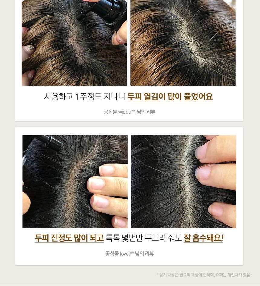 Buy NARD Hair Loss Control Tonic in Bulk