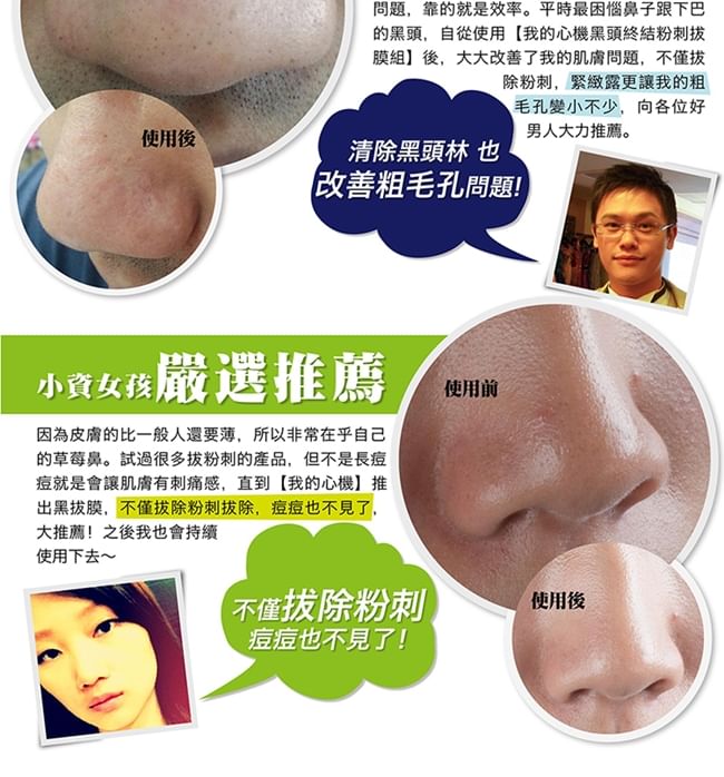 Buy My Scheming Blackhead Removal Activated Carbon Mask Set in Bulk