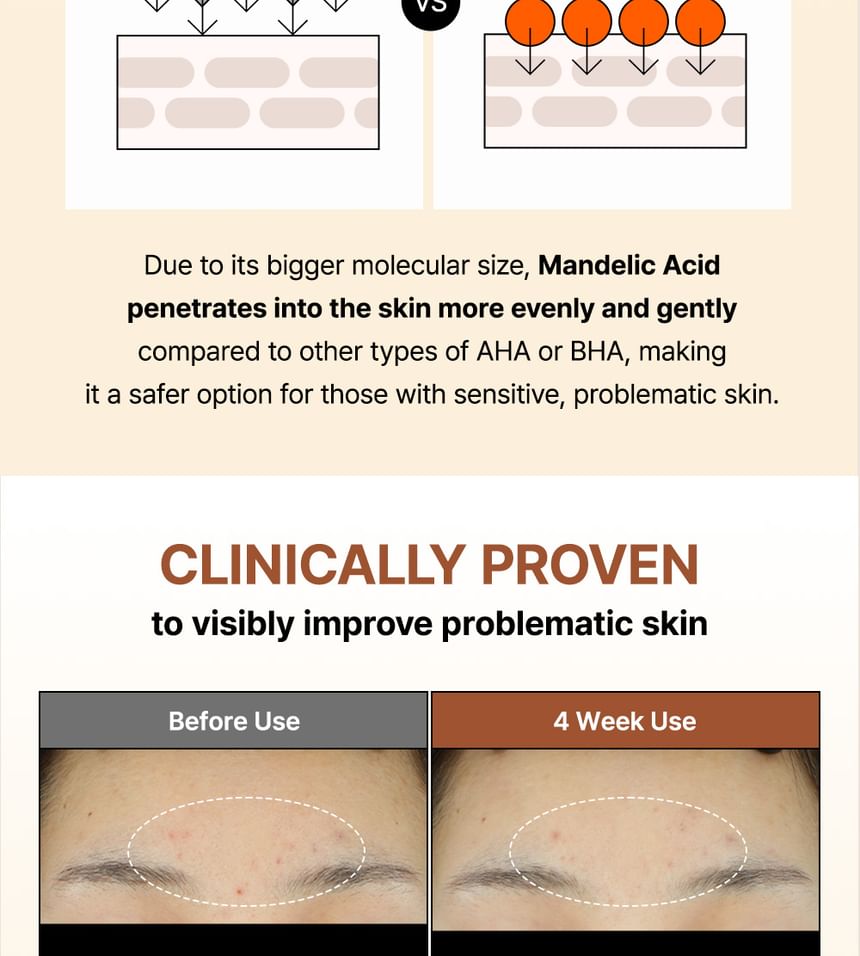 Mandelic Acid Gentle Exfoliating Toner Mini