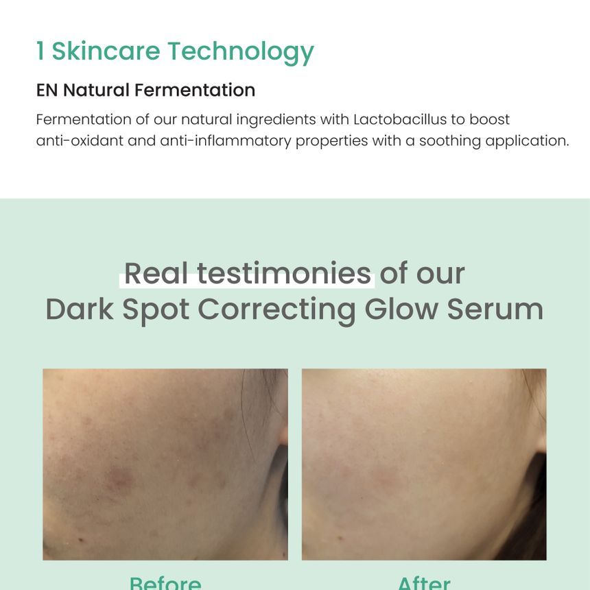 Dark spot correcting glow