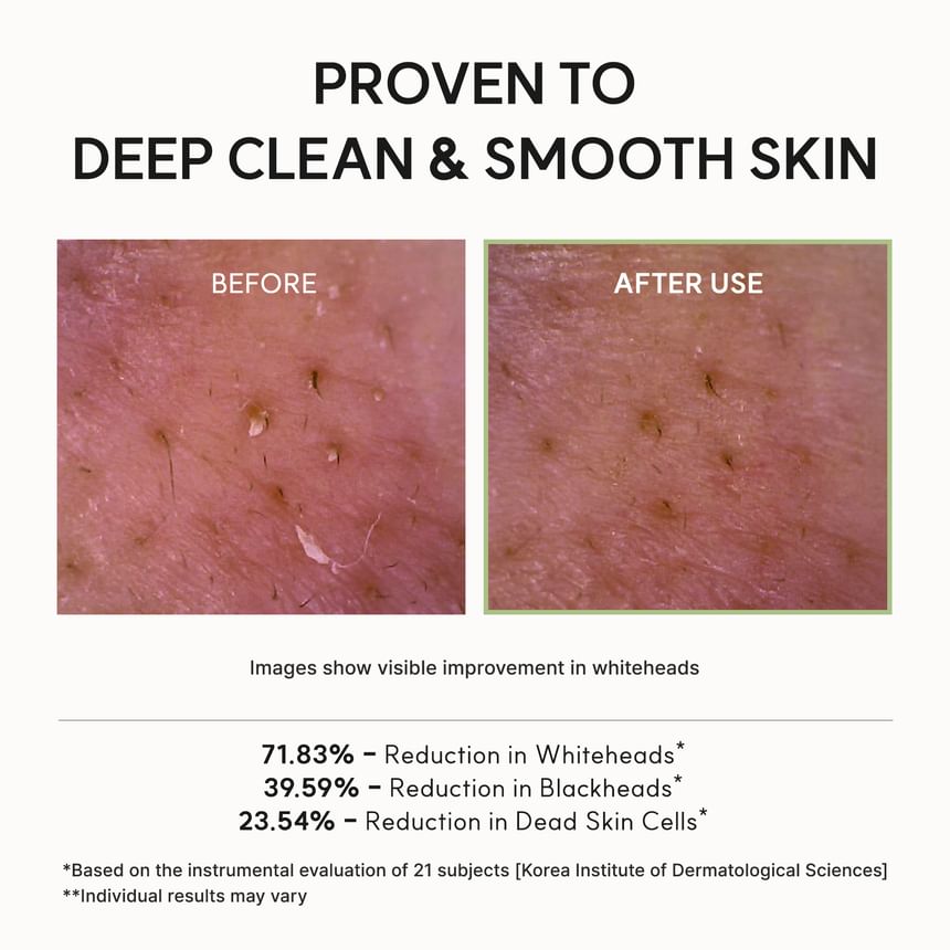 Product Detail Image 07