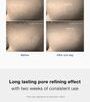 Zero Pore One Day Serum
