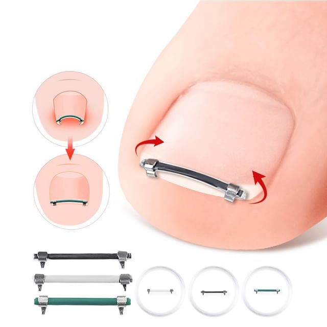 HATHA-Ingrown Toenail Corrector Clip